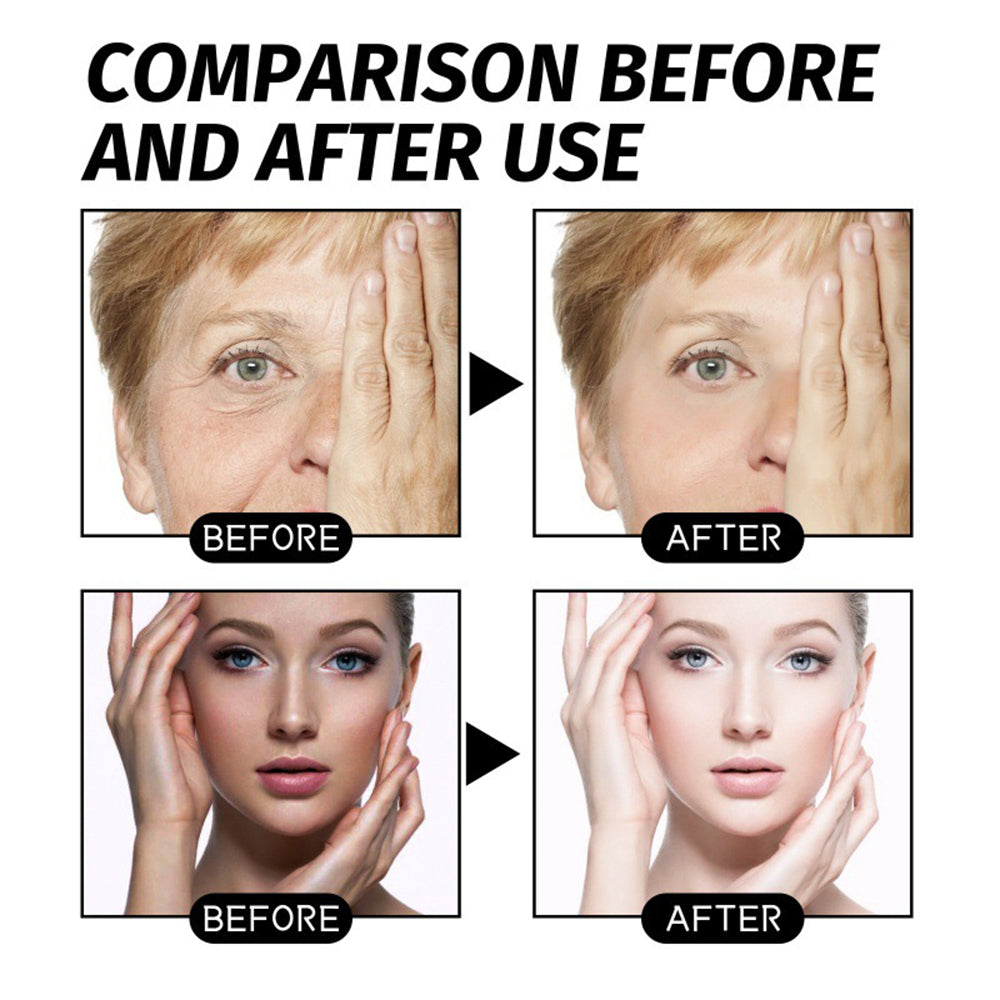 ✨Sale Happening Now:60 OFF✨ ANTI-WRINKLE SKINCARE SET Eye Cream + Neck Cream-Perfect Duo