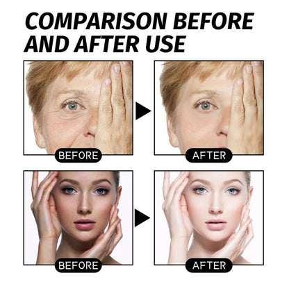 ✨Sale Happening Now:60 OFF✨ ANTI-WRINKLE SKINCARE SET Eye Cream + Neck Cream-Perfect Duo