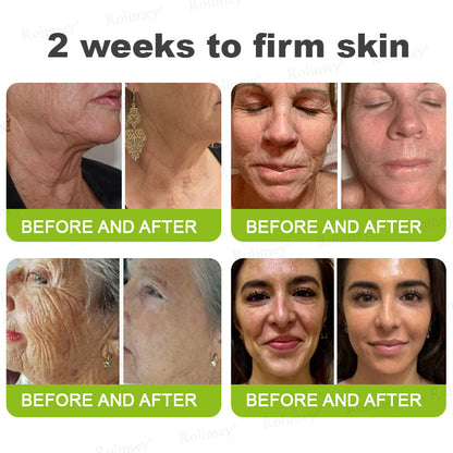 ✨✅👨‍⚕️Made and shipped from the UK 💫Rolimey® Botox & Vita-A Retinol Shot Wrinkle-Lift Tightening cream - Last Day Promotion 70% OFF