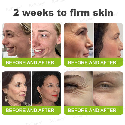✨✅👨‍⚕️Made and shipped from the UK 💫Rolimey® Botox & Vita-A Retinol Shot Wrinkle-Lift Tightening cream - Last Day Promotion 70% OFF
