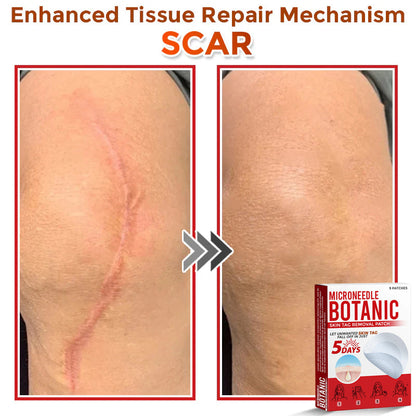 MicroNeedle Botanic Skin Tag Removal Patch 🇺🇸 Made in the USA