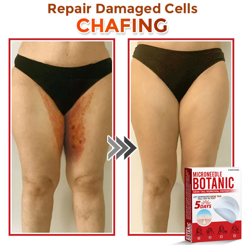 MicroNeedle Botanic Skin Tag Removal Patch 🇺🇸 Made in the USA