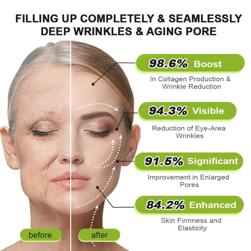 ✨✅👨‍⚕️Made and shipped from the UK 💫Rolimey® Botox & Vita-A Retinol Shot Wrinkle-Lift Tightening cream - Last Day Promotion 70% OFF