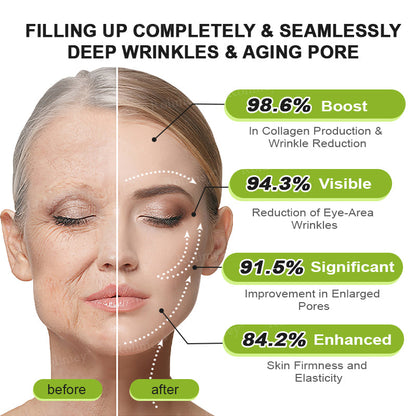 ✨✅👨‍⚕️Made and shipped from the UK 💫Rolimey® Botox & Vita-A Retinol Shot Wrinkle-Lift Tightening cream - Last Day Promotion 70% OFF