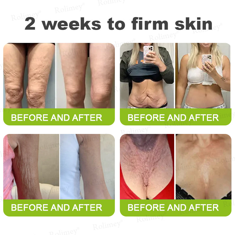 ✨✅👨‍⚕️Made and shipped from the UK 💫Rolimey® Botox & Vita-A Retinol Shot Wrinkle-Lift Tightening cream - Last Day Promotion 70% OFF