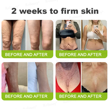 ✨✅👨‍⚕️Made and shipped from the UK 💫Rolimey® Botox & Vita-A Retinol Shot Wrinkle-Lift Tightening cream - Last Day Promotion 70% OFF
