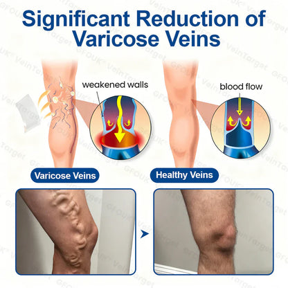 🇦🇺💧👩‍🔬GFOUK® VeinTarget Microneedle Patch⚡Instant Relief, Long-Term Results