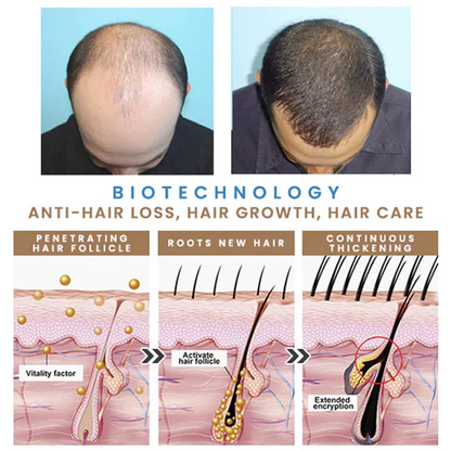 Last Day Promotion 70% OFF - 🔥Put an end to hair loss with LOVILDS™ Rollerball Serum!
