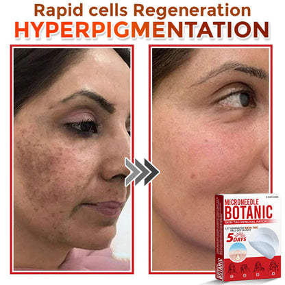 MicroNeedle Botanic Skin Tag Removal Patch 🇺🇸 Made in the USA
