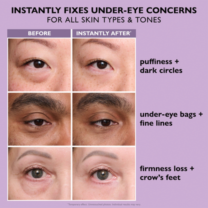Sale Happening Now:70%OFF🔥 Instant Eye Tightener Easy-Wear Formula With Brush Free!