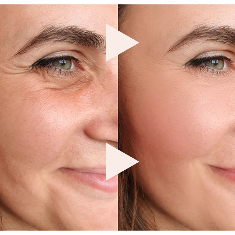 The Express Anti-Wrinkle – Instant Lifting Effect