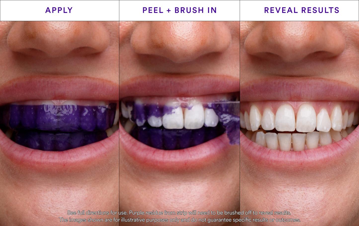 Whitening Strips
