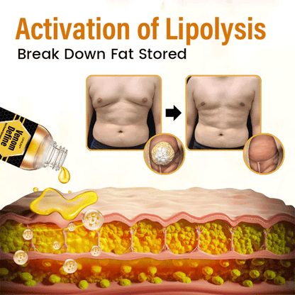 LOVILDS™ VenomDefine Bee Venom Gynecomastia Oil