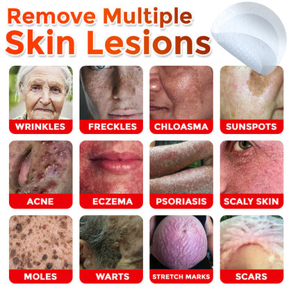 MicroNeedle Botanic Skin Tag Removal Patch 🇺🇸 Made in the USA